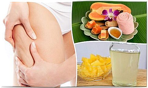 5 natural remedies to fight cellulite