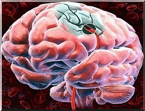 5 ways to improve brain blood flow