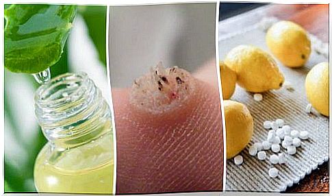 6 effective remedies to get rid of warts