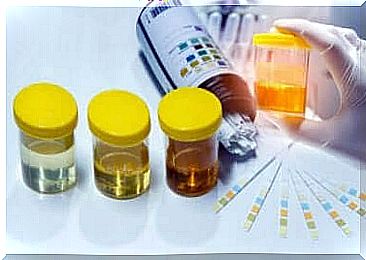 Urine samples in the diagnosis of aspenia.