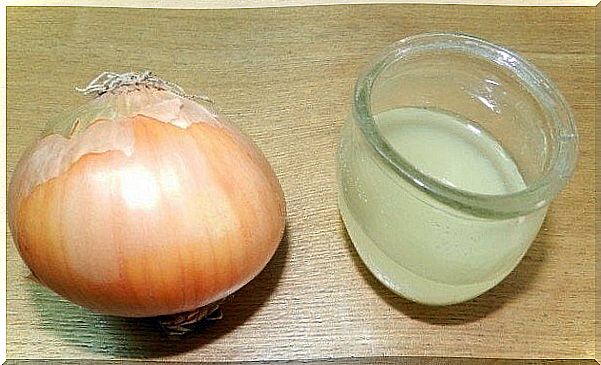 Onion and onion juice to calm the sting of sunburn