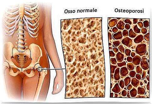 Diet to avoid osteoporosis