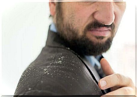 Man with dandruff on the jacket.