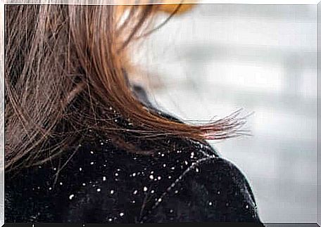 Woman looking for a natural remedy against dandruff.