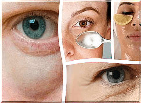 No more bags under the eyes!  Simple tips to get rid of it