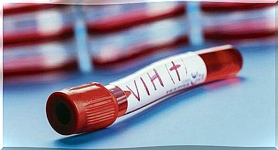 Test tube with HIV infected blood