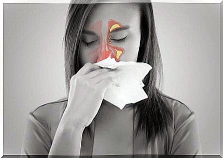 Woman with sinus inflammation.