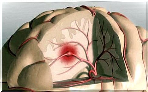 Little sleep can cause brain strokes