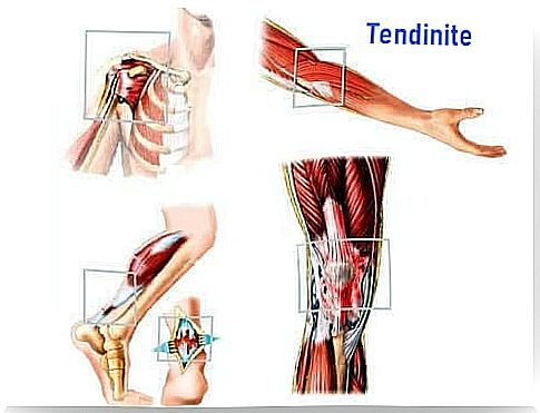 Muscle with tendonitis