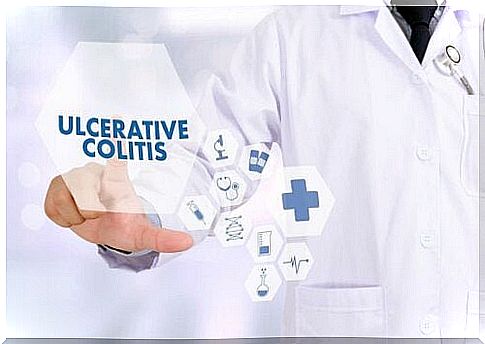 Ulcerative colitis attacks: how to prevent them?