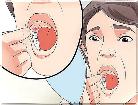 Wisdom tooth: reduce swelling after extraction